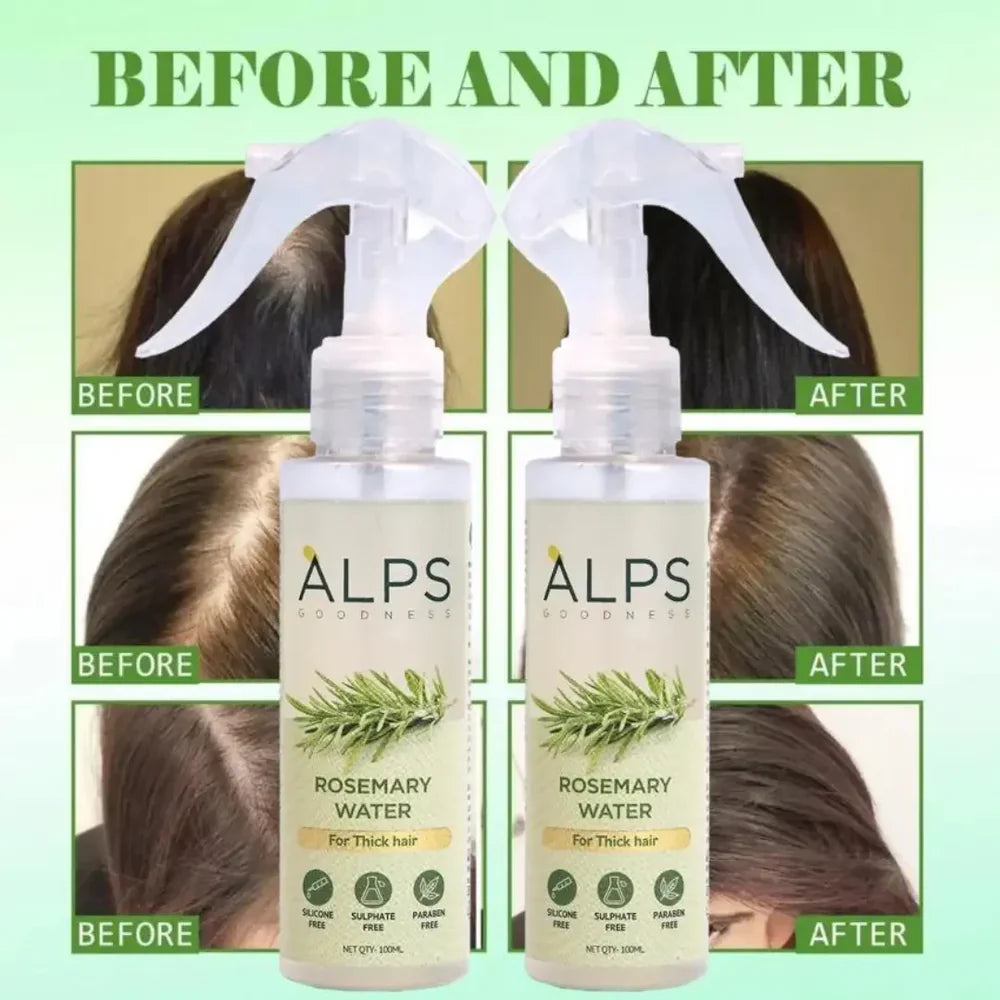 Rosemary Water Spray | For Hair Regrowth (Buy 1 Get 2 Free đ)